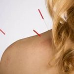 Akupunktur skulder